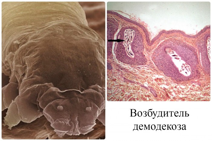 Клещ - возбудитель демодекоза